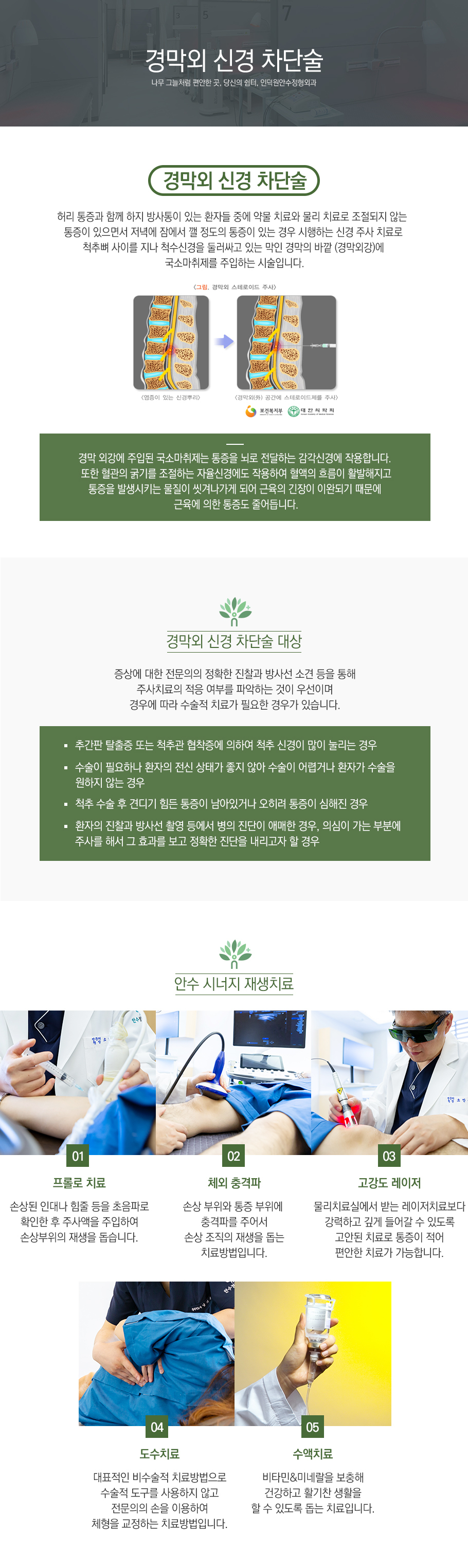 경막외신경차단술